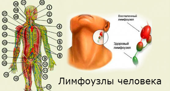 Лимфоузел справа у мужчины. Где находятся лимфатические узлы у человека схема. Где находятся лимфатические узлы у человека фото. Лимфоузлы схема расположения. Лимфоузлы на теле человека схема.