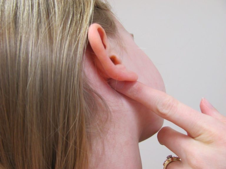 Воспаление лимфоузла за ухом у ребенка фото с пояснениями