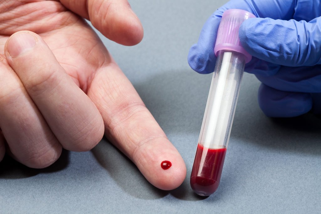 Общий анализ крови лимфоциты норма у мужчин thumbnail