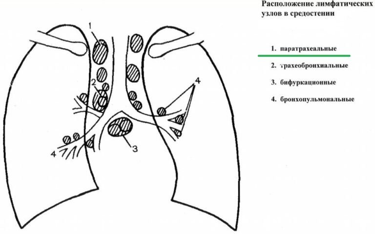 Лимфоузлы за ухом схема увеличен