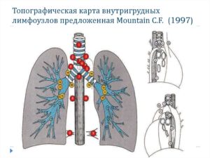 Где лимфоузлы на руках у человека фото находятся