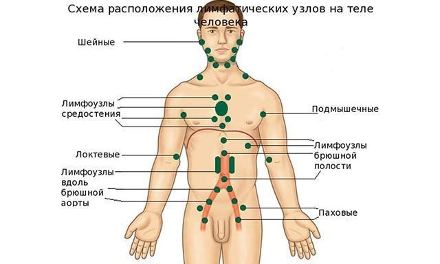 Опухоль лимфоузлов в паху у мужчин 16