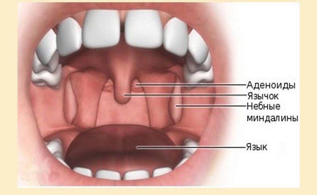 Где находятся гланды у человека как выглядят здоровые