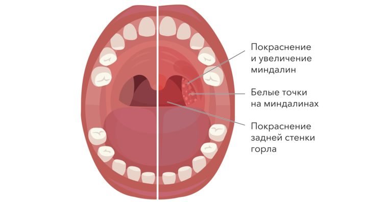 Запах из акпп