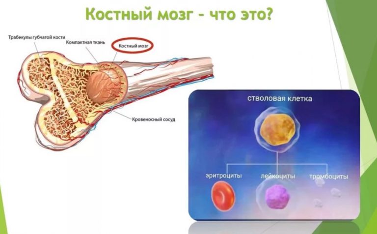 Пункция костного мозга картинки