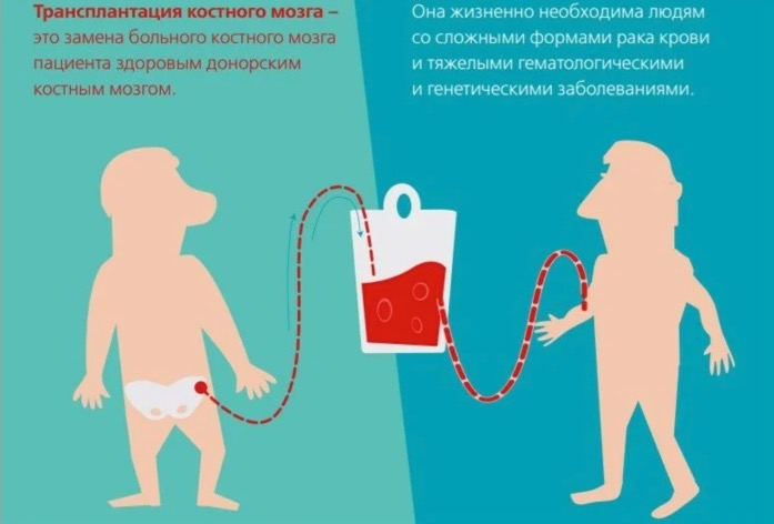 как сдают костный мозг