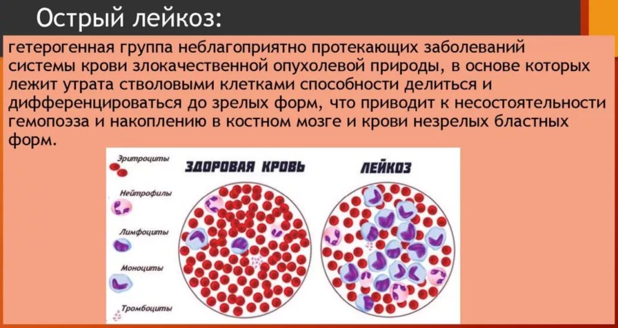 Хронические лейкозы презентация