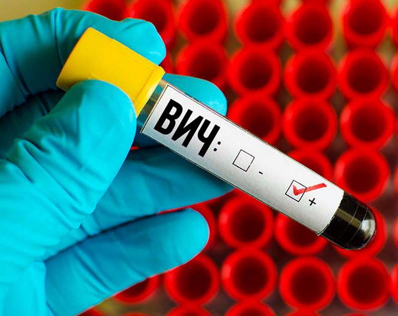 Иммунитет к ВИЧ: существует ли он?